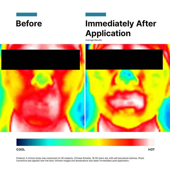 Phyto Corrective Gel - Image 4