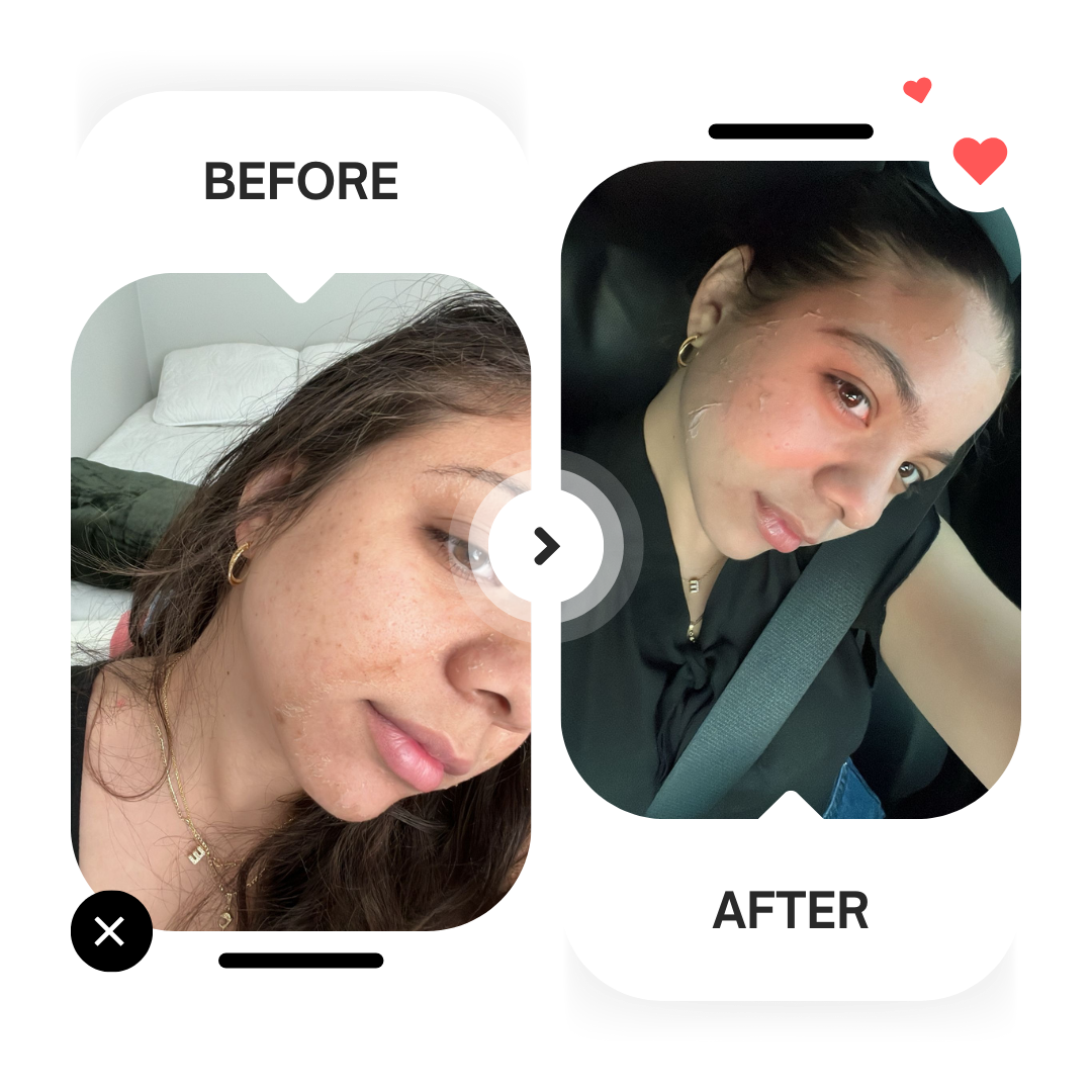 Beige Minimalist Skincare Before and After Instagram Post (1)