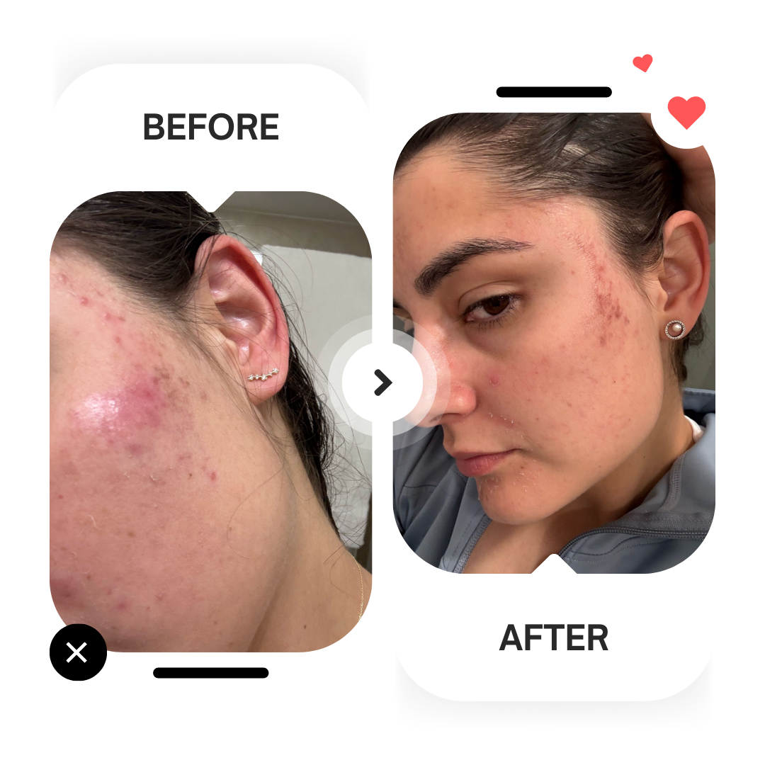 Beige Minimalist Skincare Before and After Instagram Post